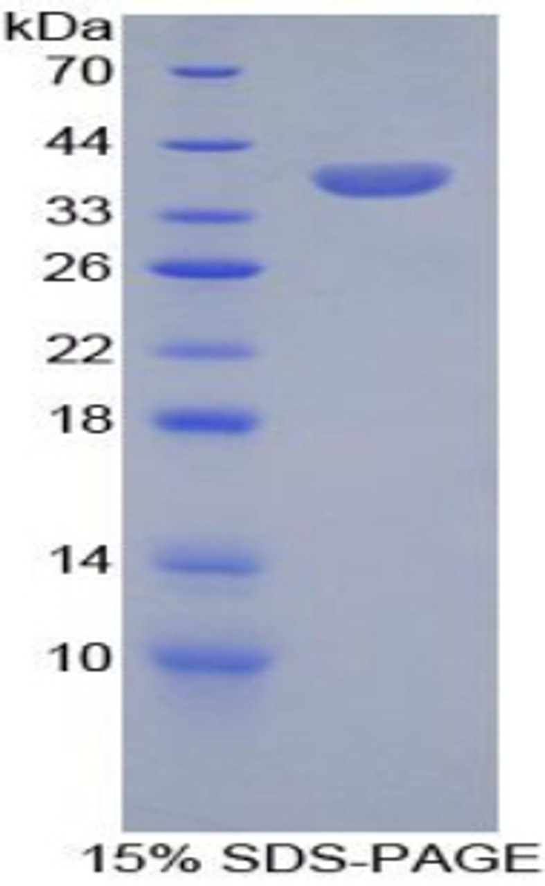 Human Recombinant Serine Peptidase Inhibitor Kazal Type 1 (SPINK1)