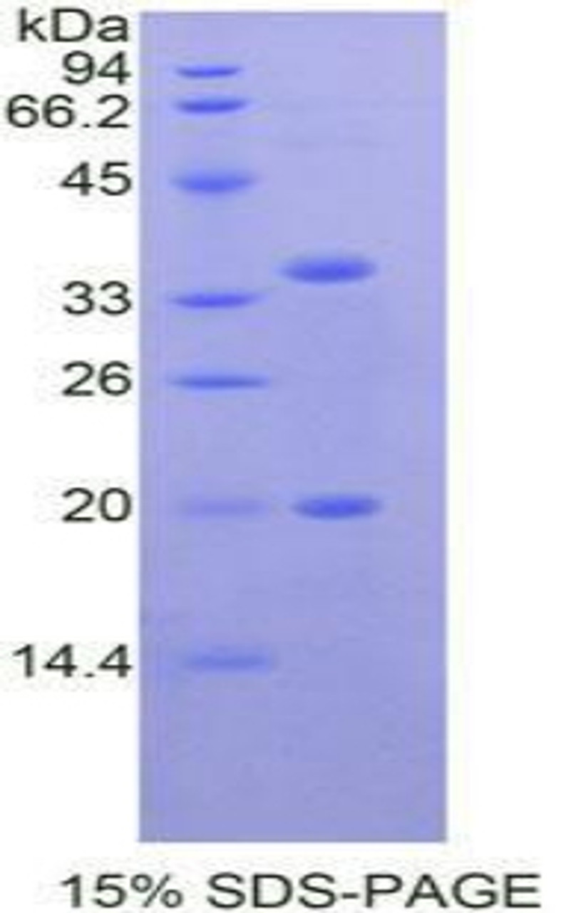 Human Recombinant Serine Peptidase Inhibitor Kazal Type 5 (SPINK5)