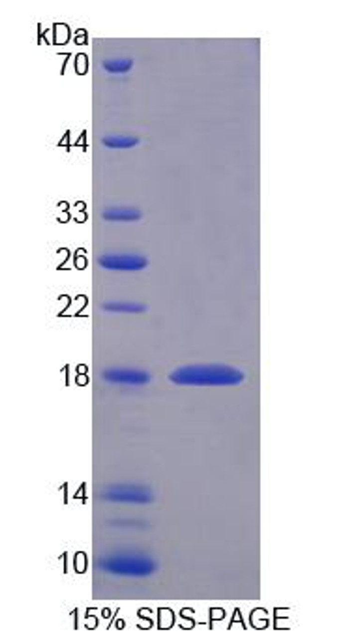 Human Recombinant SNAP Associated Protein (SNAPAP)