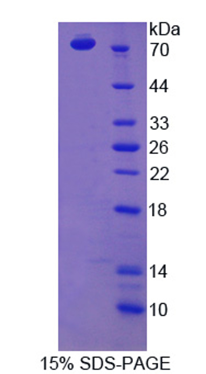 Rat Recombinant Scavenger Receptor Class B Member 1 (SCARB1)