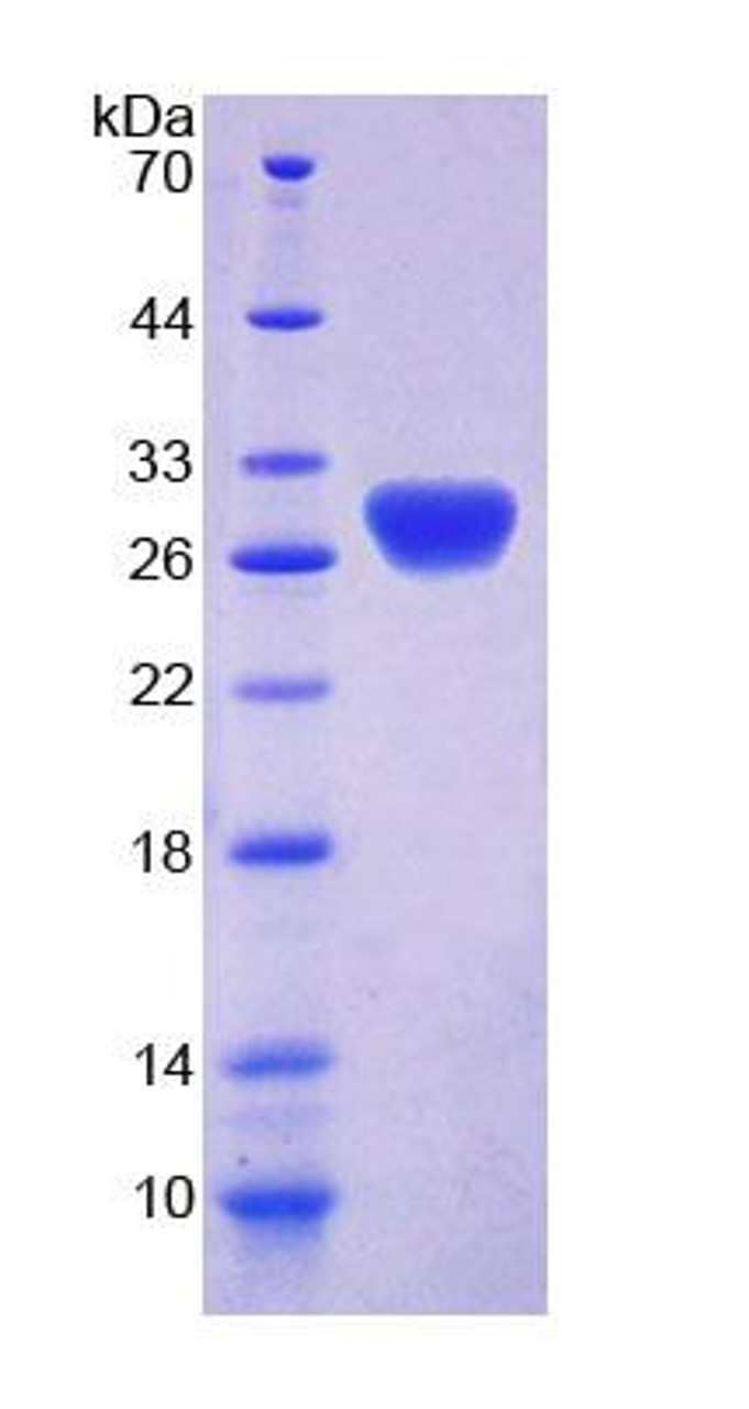 Mouse Recombinant Retbindin (RTBDN)