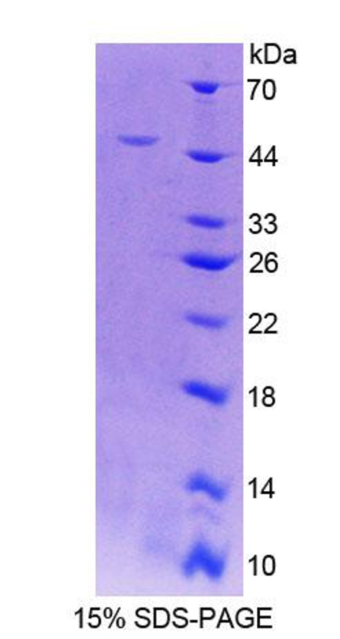 Human Recombinant Riboflavin Kinase (RFK)