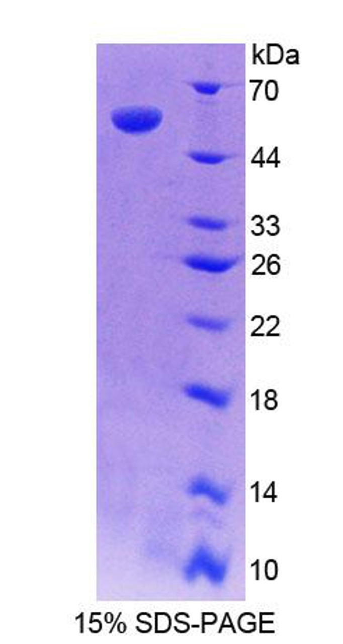 Human Recombinant Retinoic Acid Receptor Responder 1 (RARRES1)