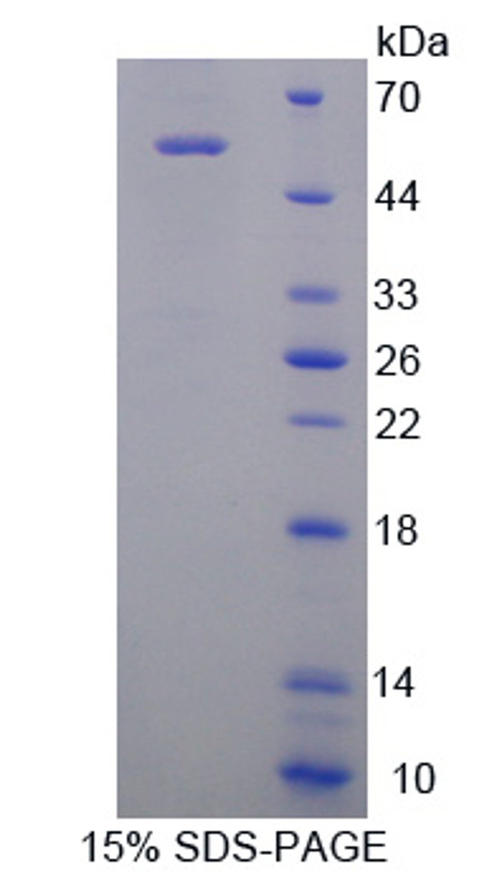 Rat Recombinant Renal Tumor Antigen (RAGE)