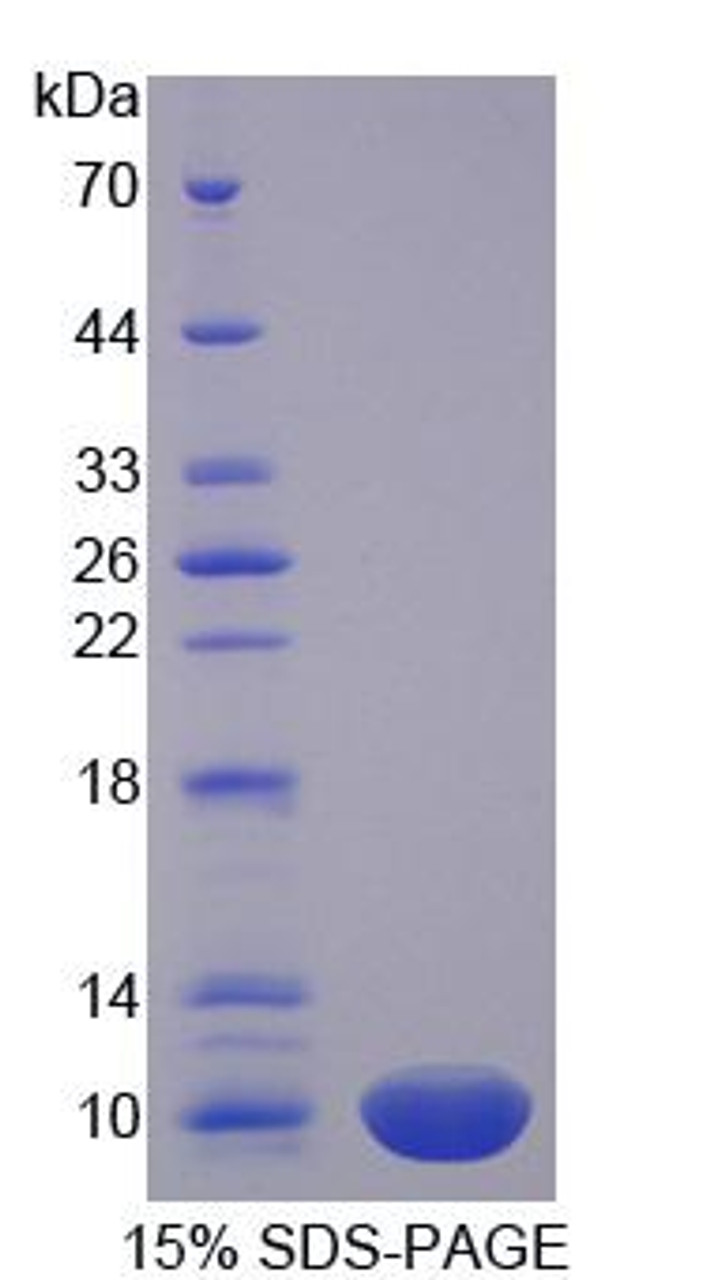 Human Recombinant Protamine 1 (PRM1)