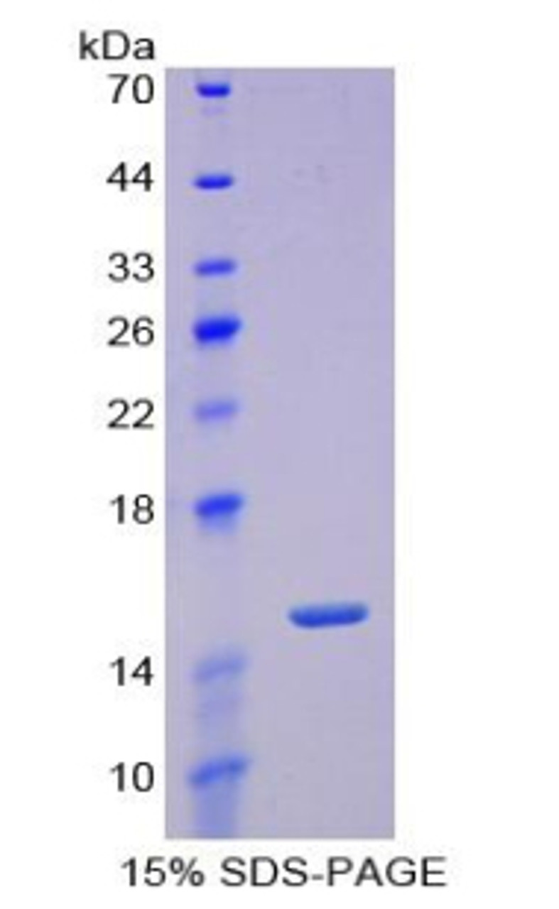 Mouse Recombinant Periostin (POSTN)