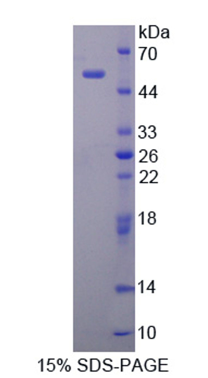 Human Recombinant Palate/Lung And Nasal Epithelium Associated Protein (PLUNC)