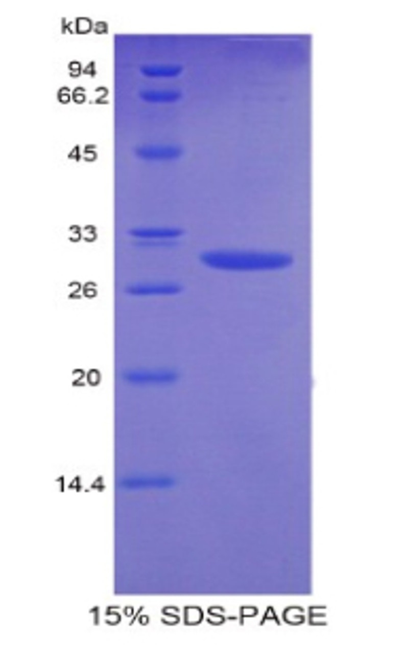 Mouse Recombinant Plastin 3 (PLS3)