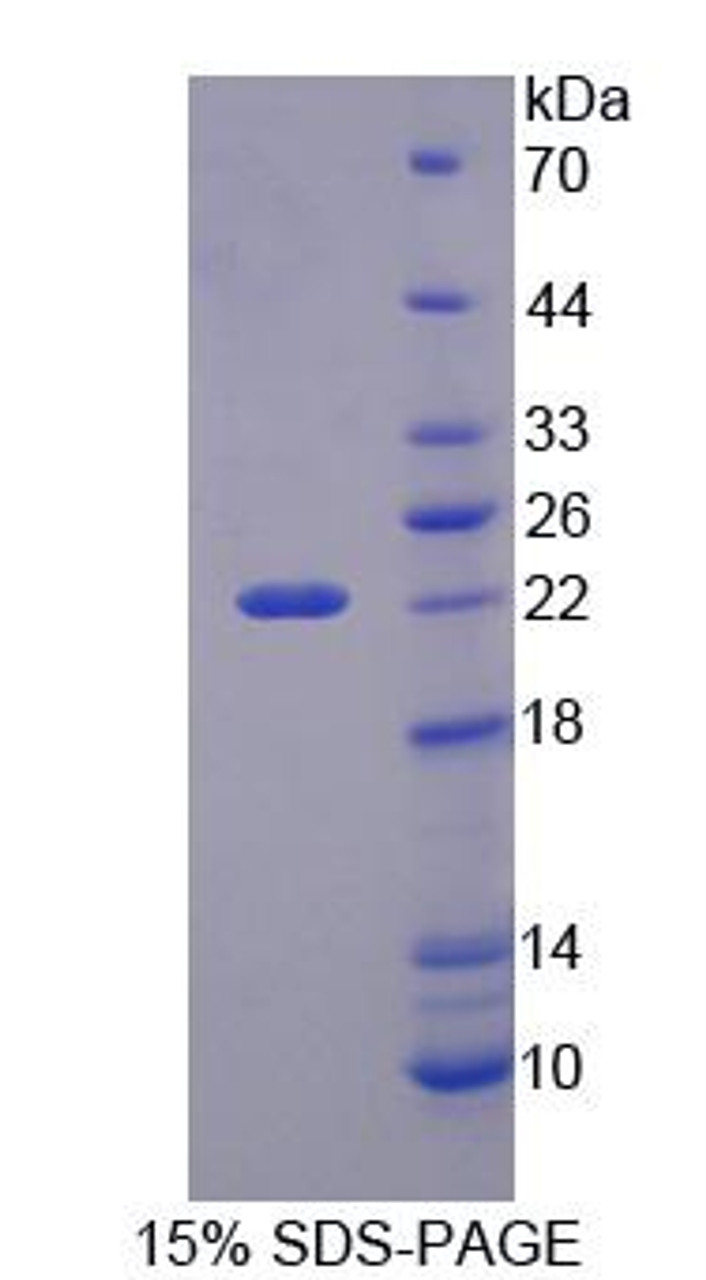 Mouse Recombinant PHD Finger Protein 8 (PHF8)