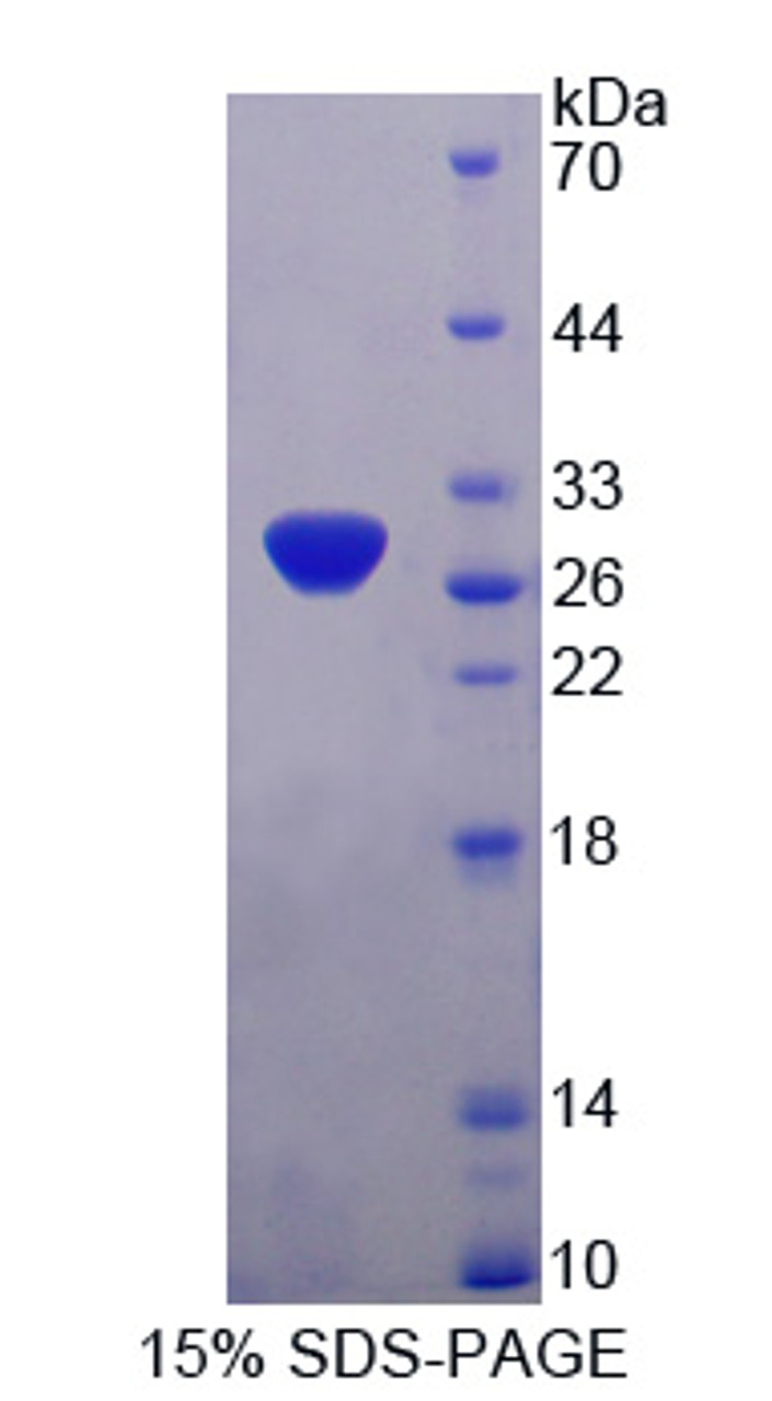 Human Recombinant Pyruvate Dehydrogenase Complex Component X (PDHX)