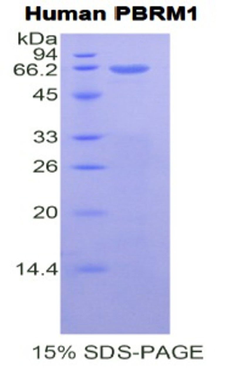 Human Recombinant Polybromo 1 (PBRM1)