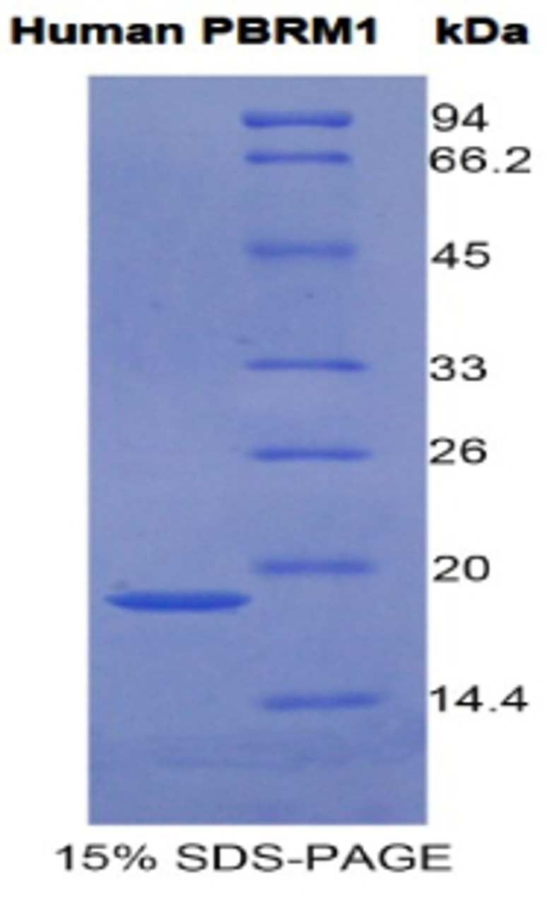 Human Recombinant Polybromo 1 (PBRM1)