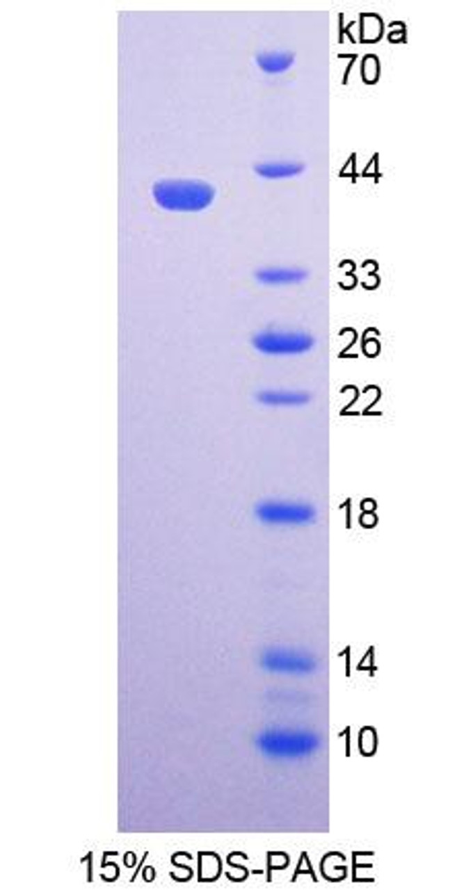 Human Recombinant Paired Box Gene 9 (PAX9)