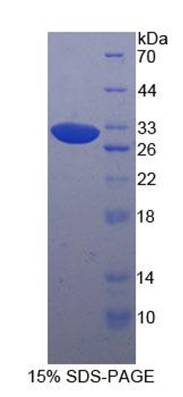 Human Recombinant p21 Protein Activated Kinase 4 (PAK4)