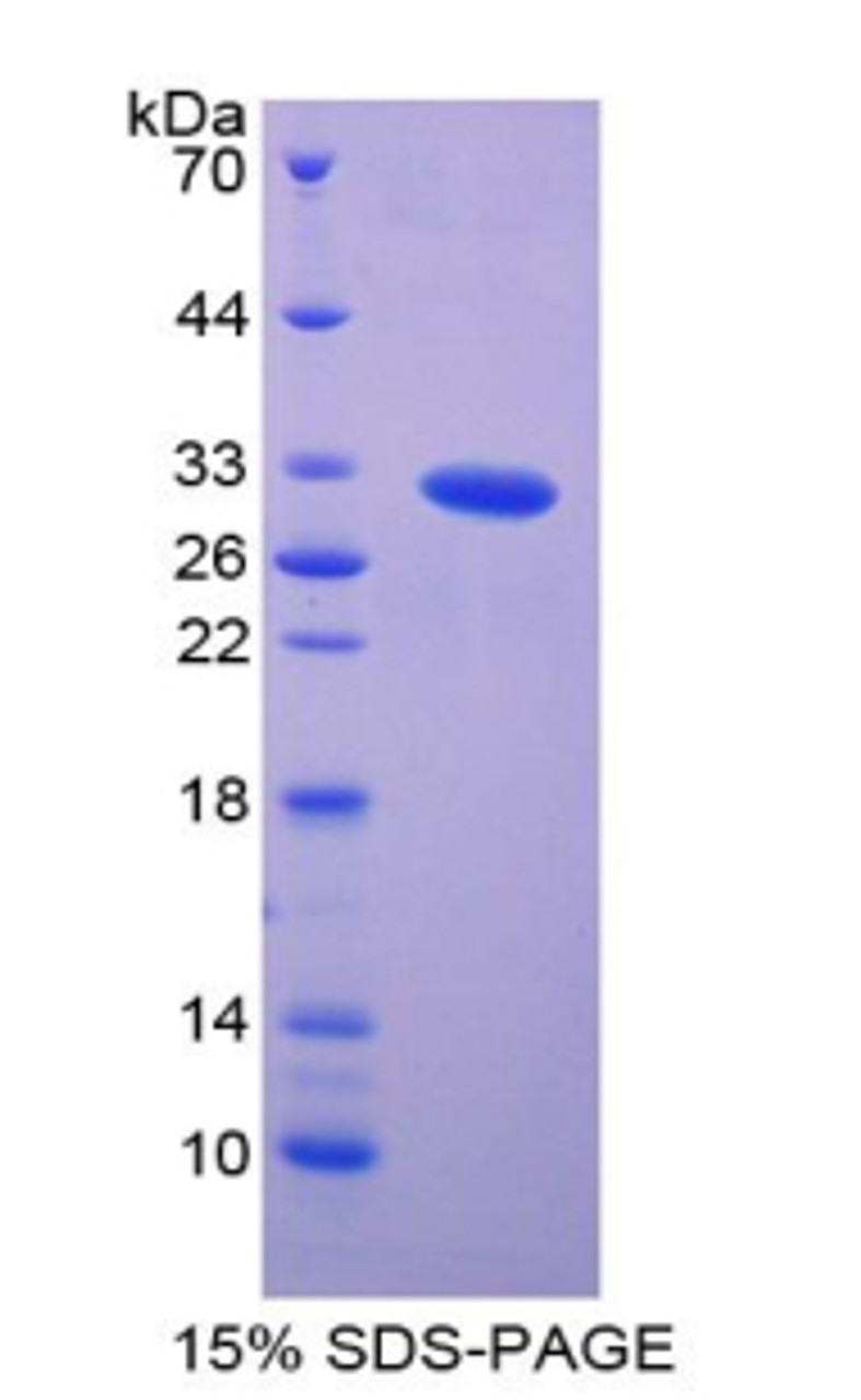 Human Recombinant p21 Protein Activated Kinase 2 (PAK2)