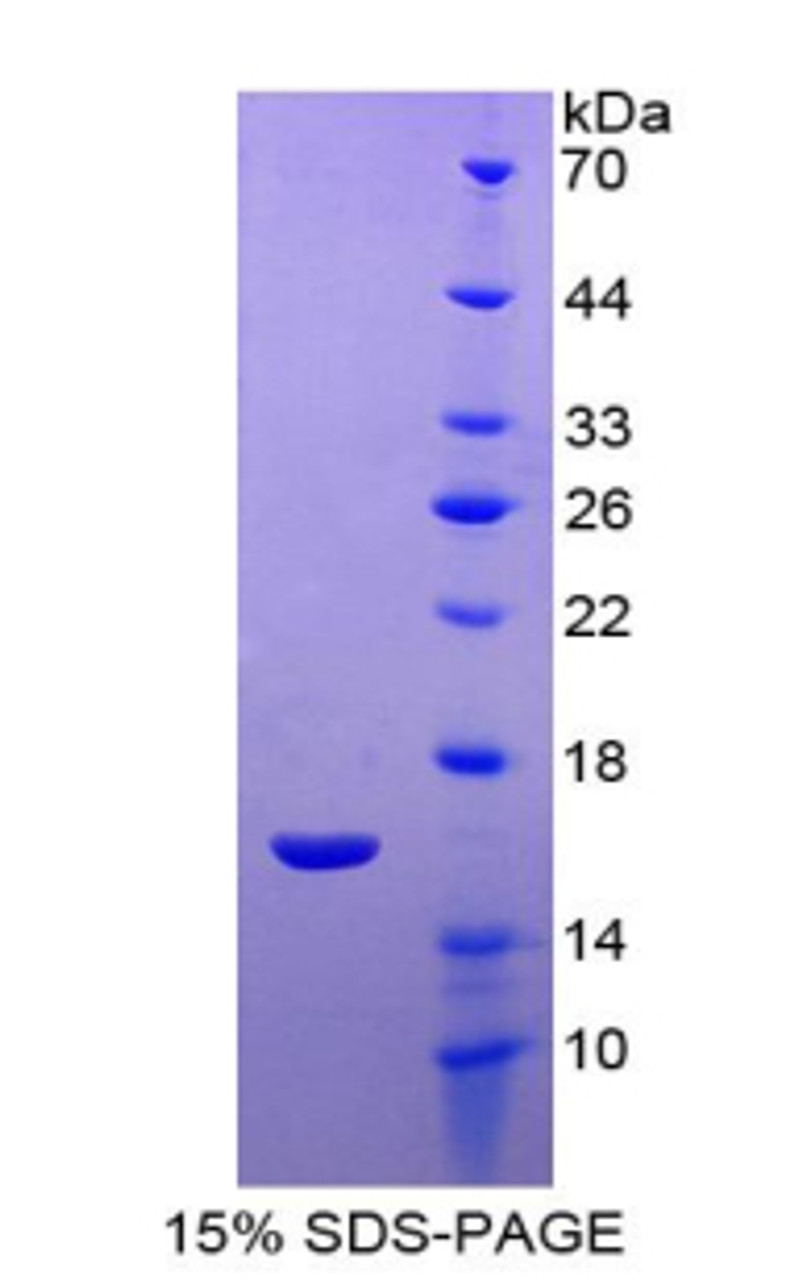 Human Recombinant Neuritin 1 (NRN1)