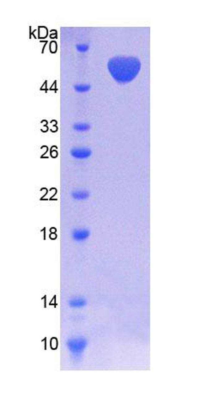 Human Recombinant NAD Kinase (NADK)