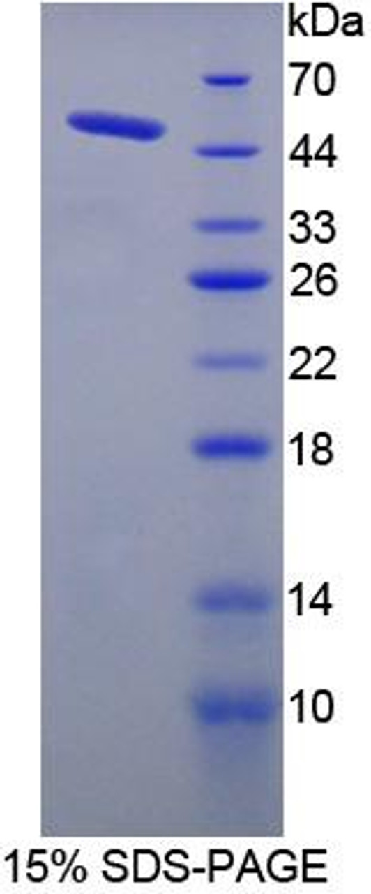 Human Recombinant Mannose Phosphate Isomerase (MPI)