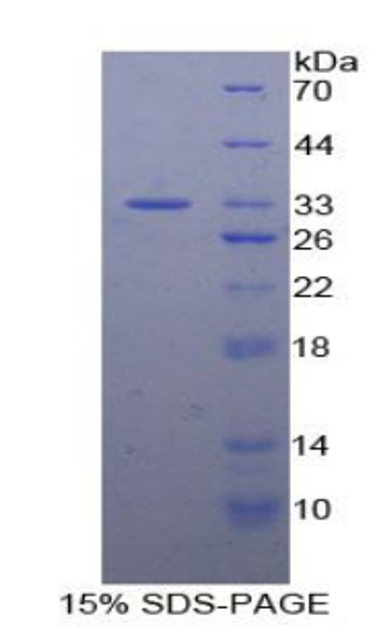 Mouse Recombinant N-Methylpurine DNA Glycosylase (MPG)