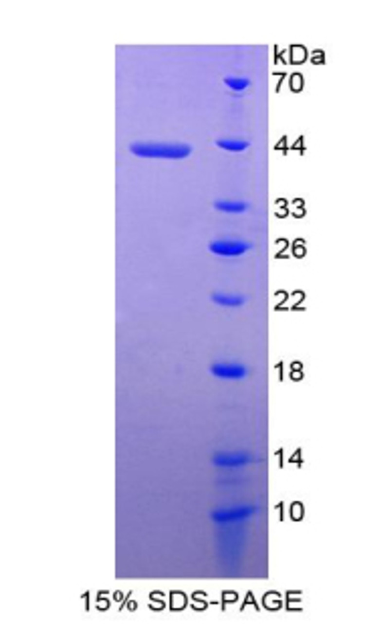 Rat Recombinant Melanoma Inhibitory Activity Protein 1 (MIA1)