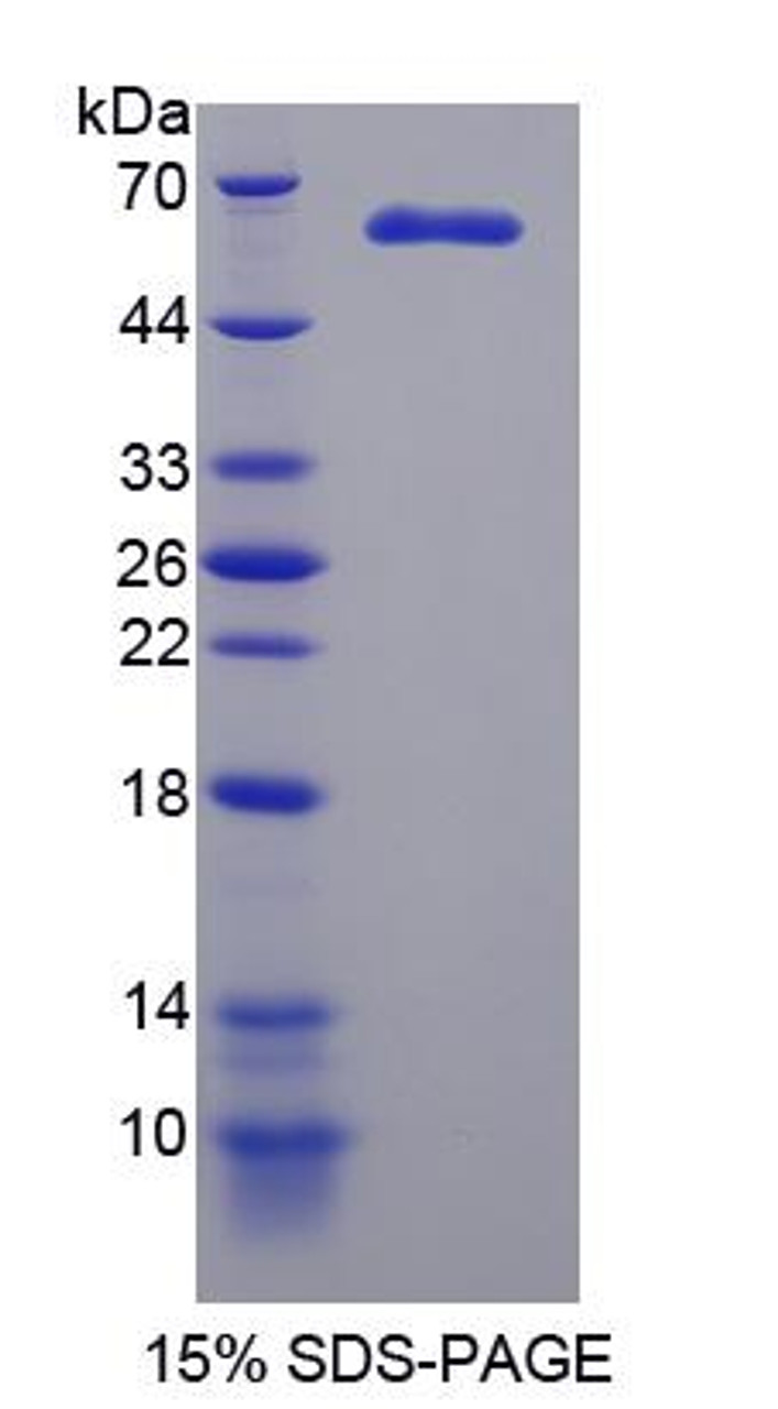 Human Recombinant Microtubule Associated Serine/Threonine Kinase 2 (MAST2)