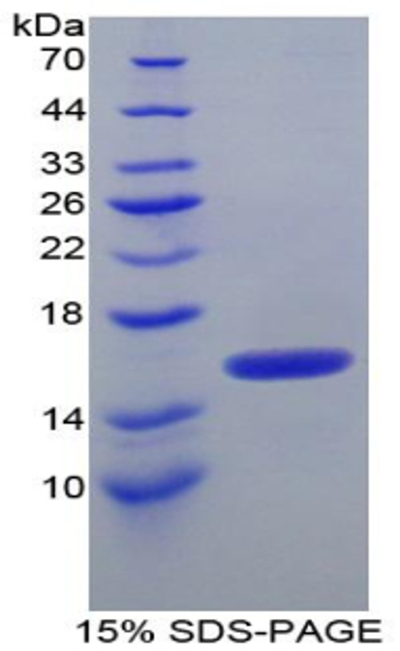 Human Recombinant Inter Alpha-Globulin Inhibitor H4 (ITIH4)