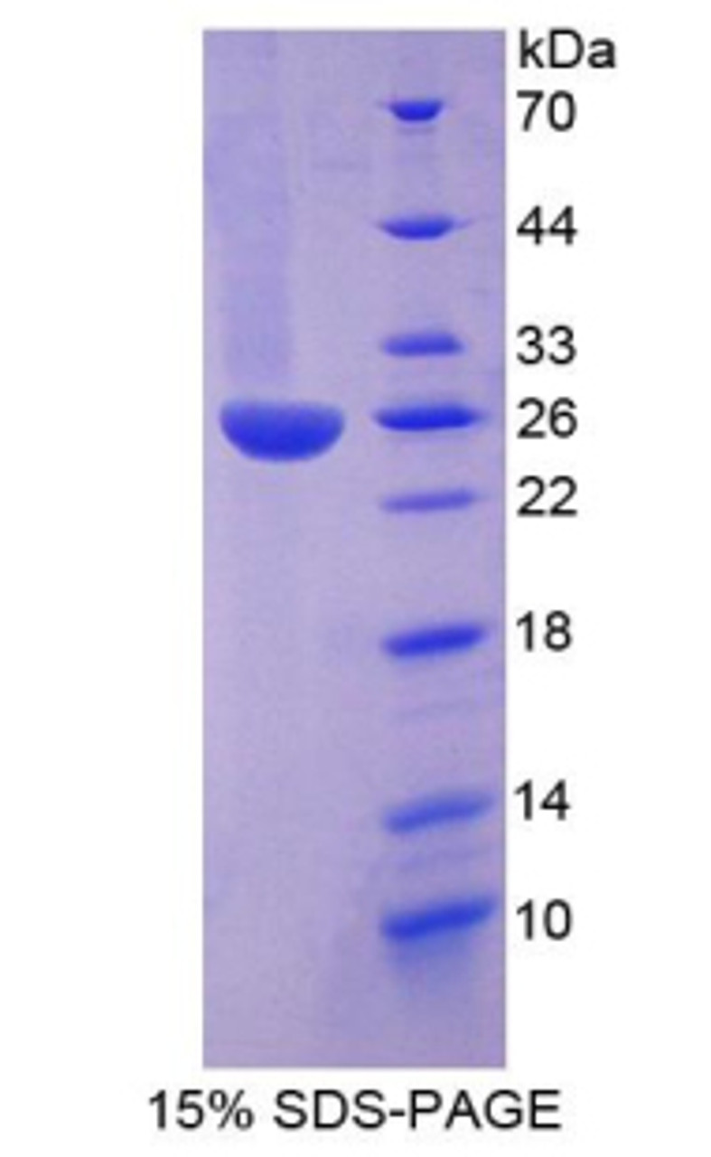 Human Recombinant Inter Alpha-Globulin Inhibitor H3 (ITIH3)