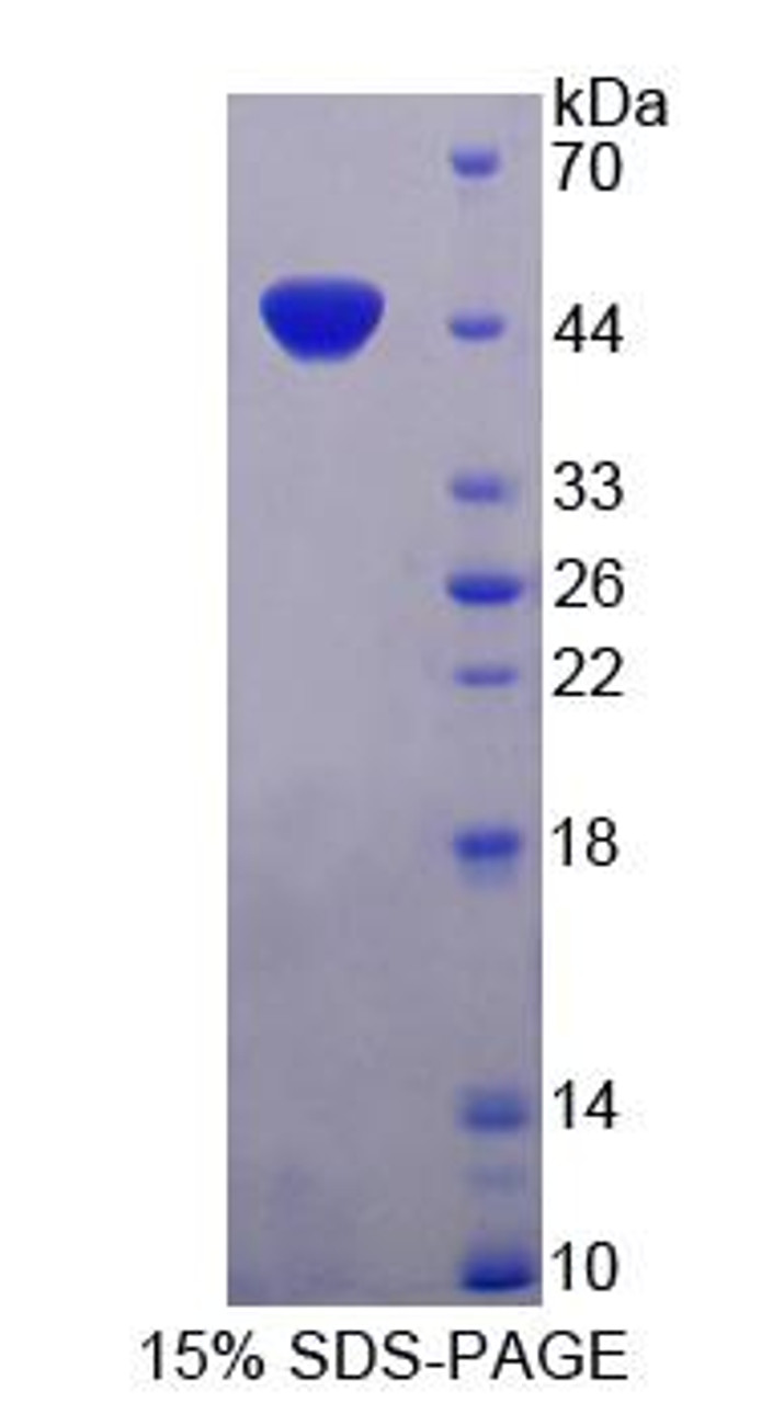 Human Recombinant Immunoglobulin Superfamily Containing Leucine Rich Repeat Protein (ISLR)