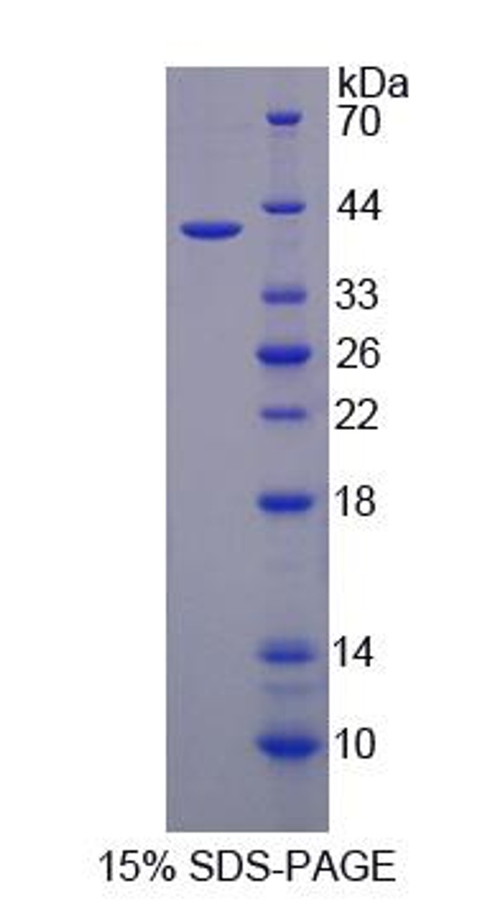 Rat Recombinant Iron Responsive Element Binding Protein 2 (IREB2)