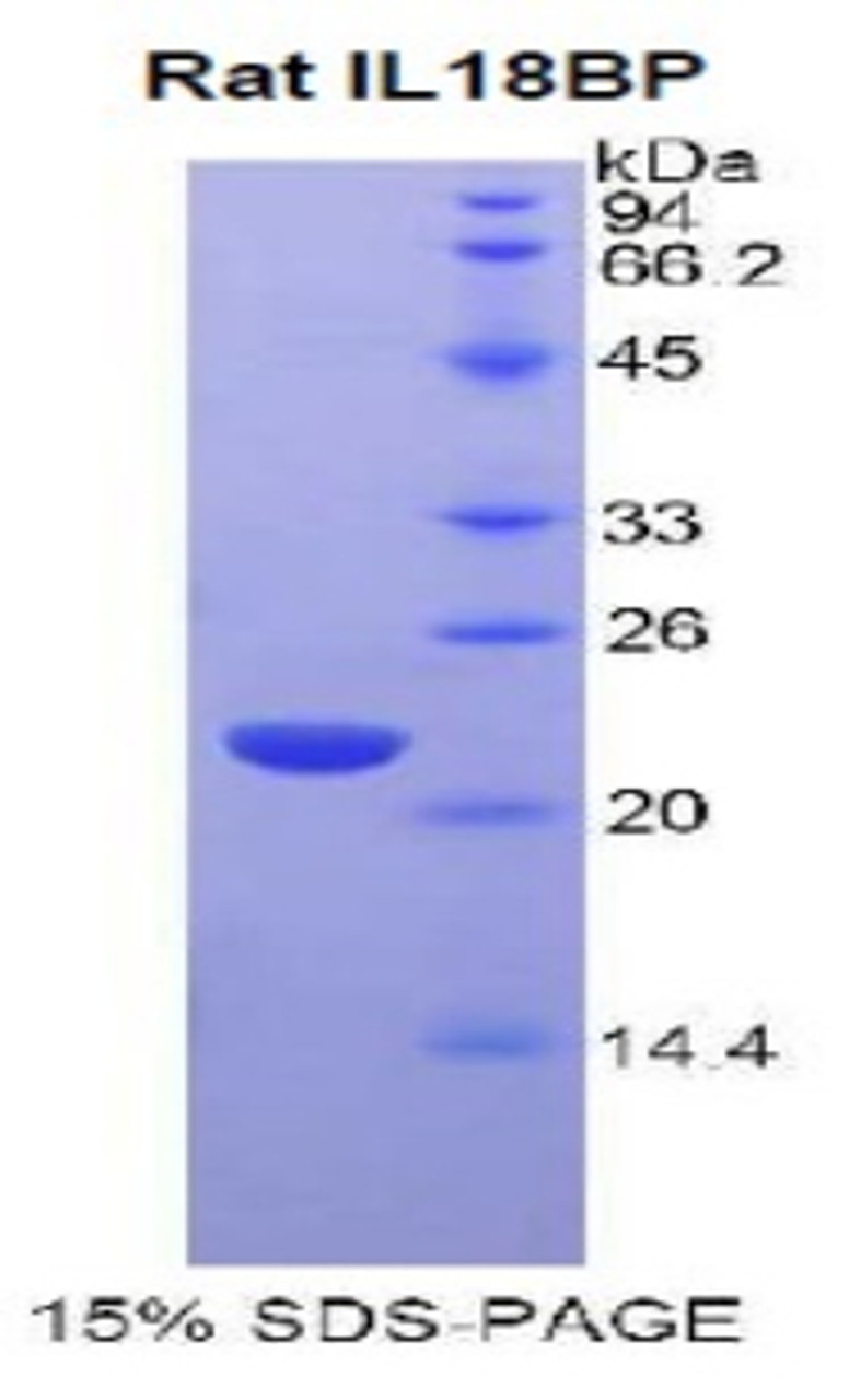 Rat Recombinant Interleukin 18 Binding Protein (IL18BP)