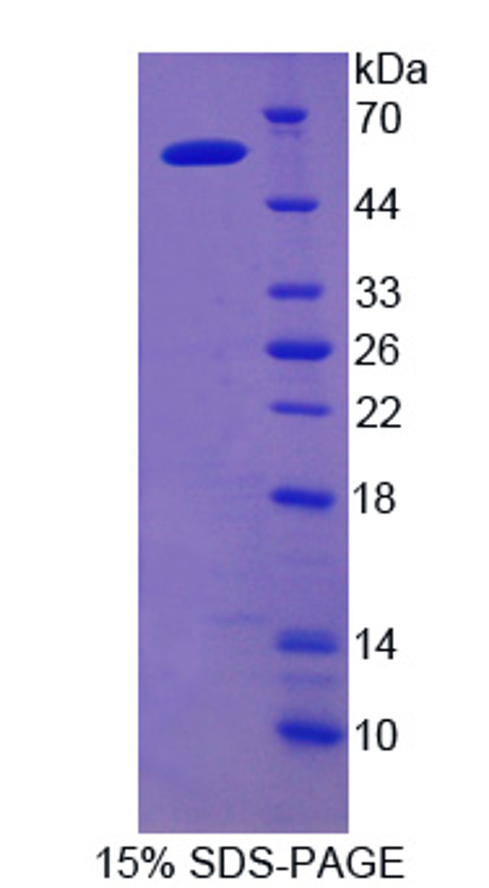 Rat Recombinant Iduronate-2-Sulfatase (IDS)