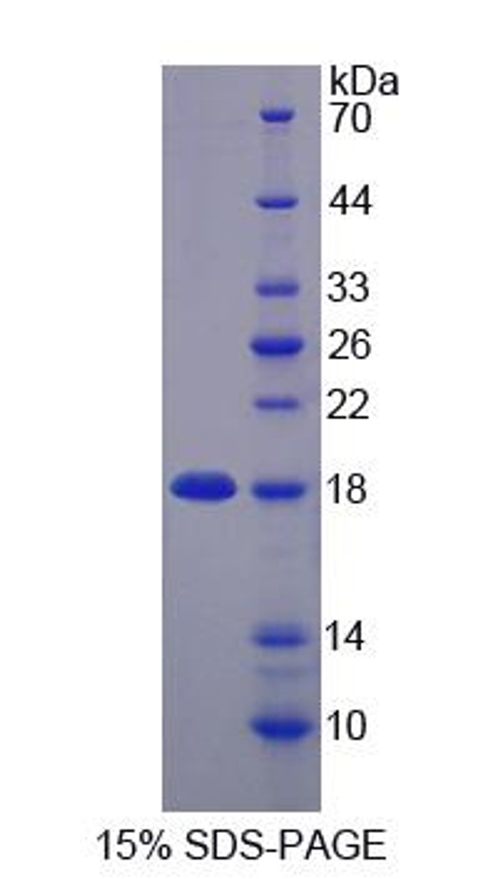 Human Recombinant Zinc Ribbon Domain Containing Protein 1 (ZNRD1)