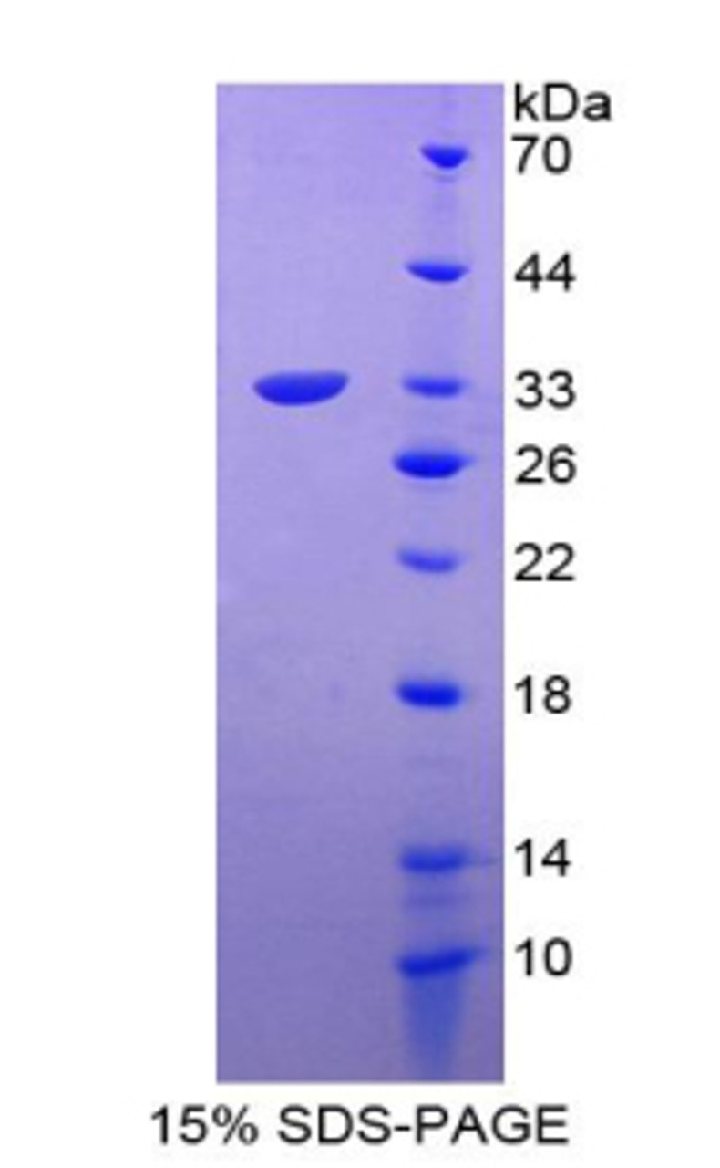 Human Recombinant T-Box Protein 4 (TBX4)