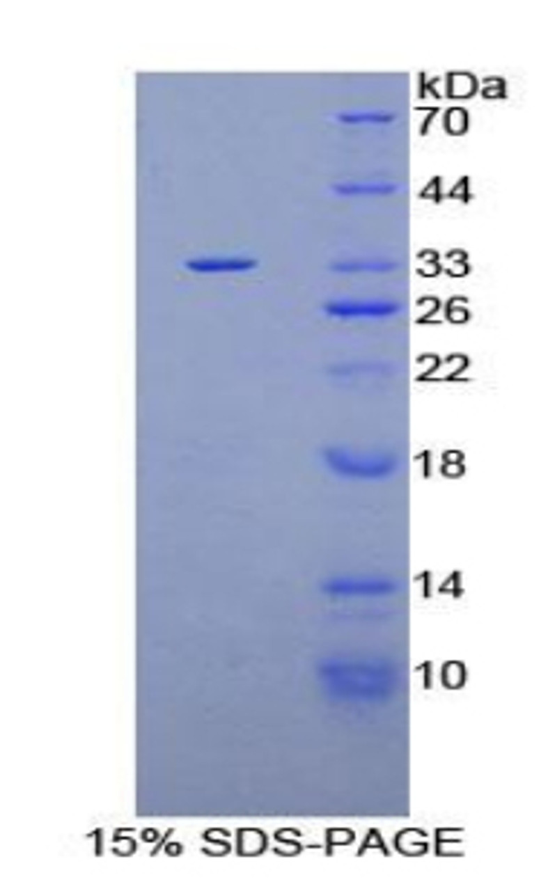 Human Recombinant Pleckstrin Homology Domain Containing Family A, Member 1 (PLEKHA1)