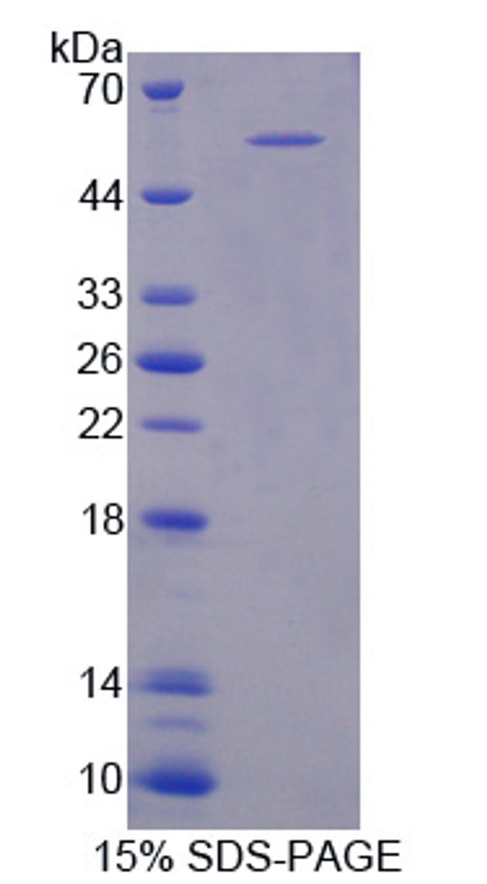 Mouse Recombinant Pleckstrin Homology Domain Containing Family A, Member 1 (PLEKHA1)