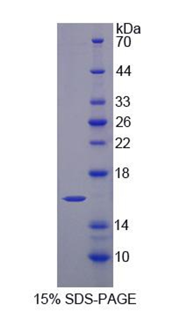 Mouse Recombinant Histidine Triad Nucleotide Binding Protein 2 (HINT2)