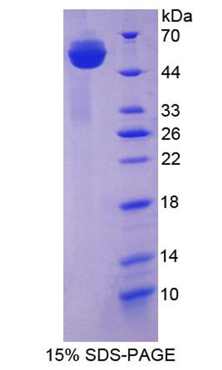 Human Recombinant Huntingtin Associated Protein 1 (HAP1)
