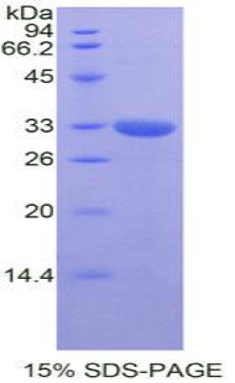 Human Recombinant GRB2 Related Adaptor Protein 2 (GRAP2)