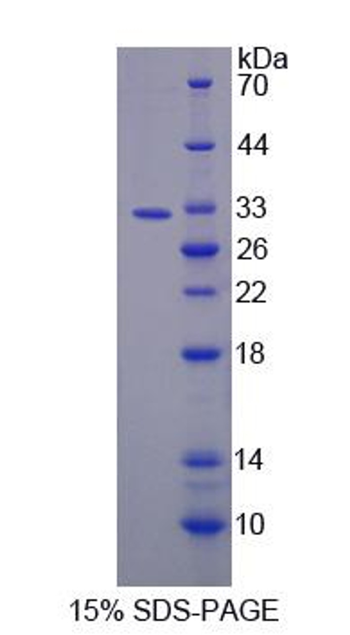 Human Recombinant Glycerol-3-Phosphate Acyltransferase, Mitochondrial (GPAM)