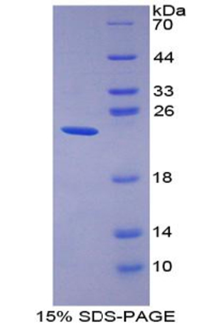 Human Recombinant Gastrokine 2 (GKN2)