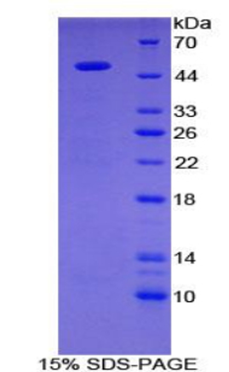 Human Recombinant Galactose-3-O-Sulfotransferase 1 (GAL3ST1)