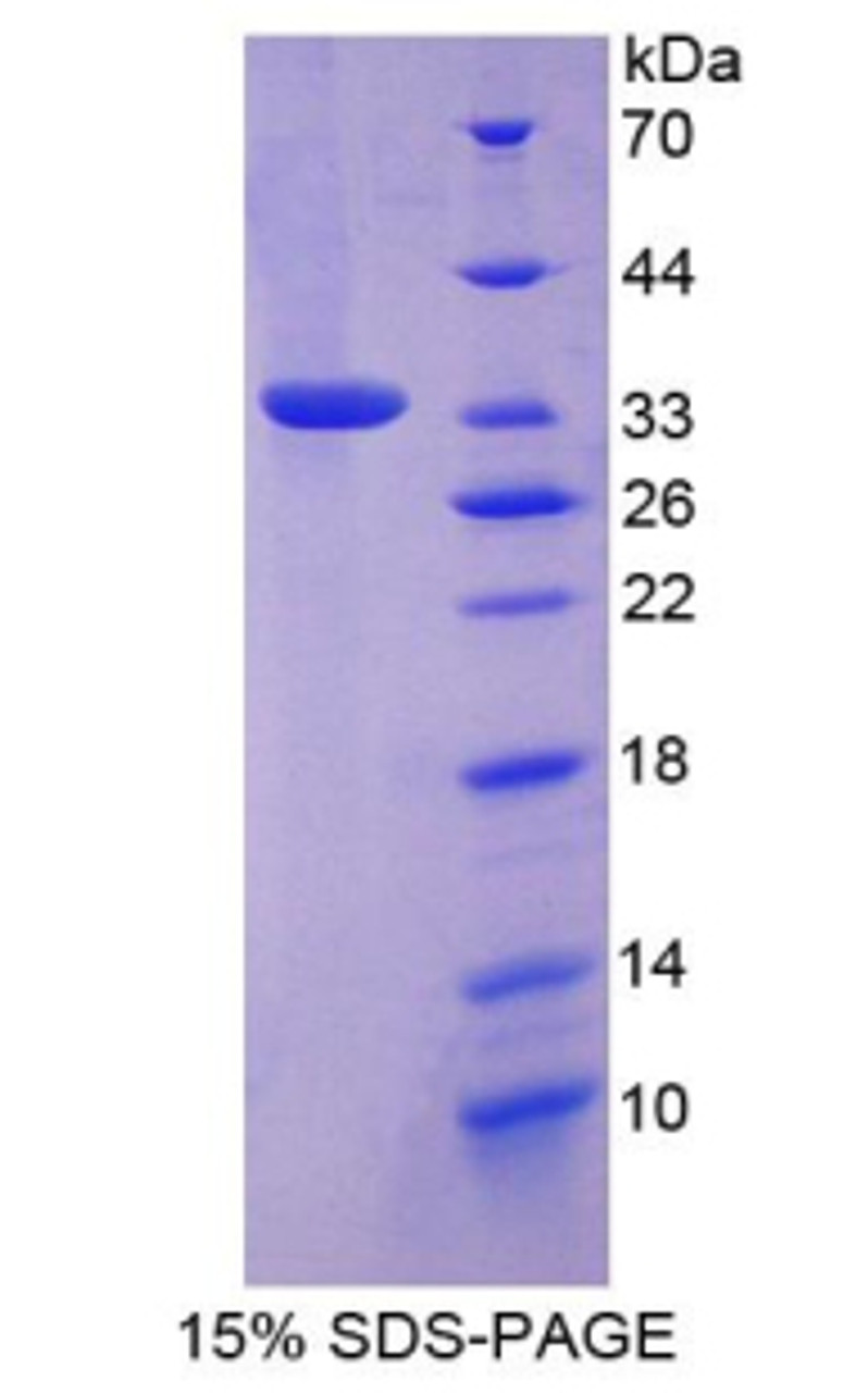 Mouse Recombinant FOS Like Antigen 1 (FOSL1)