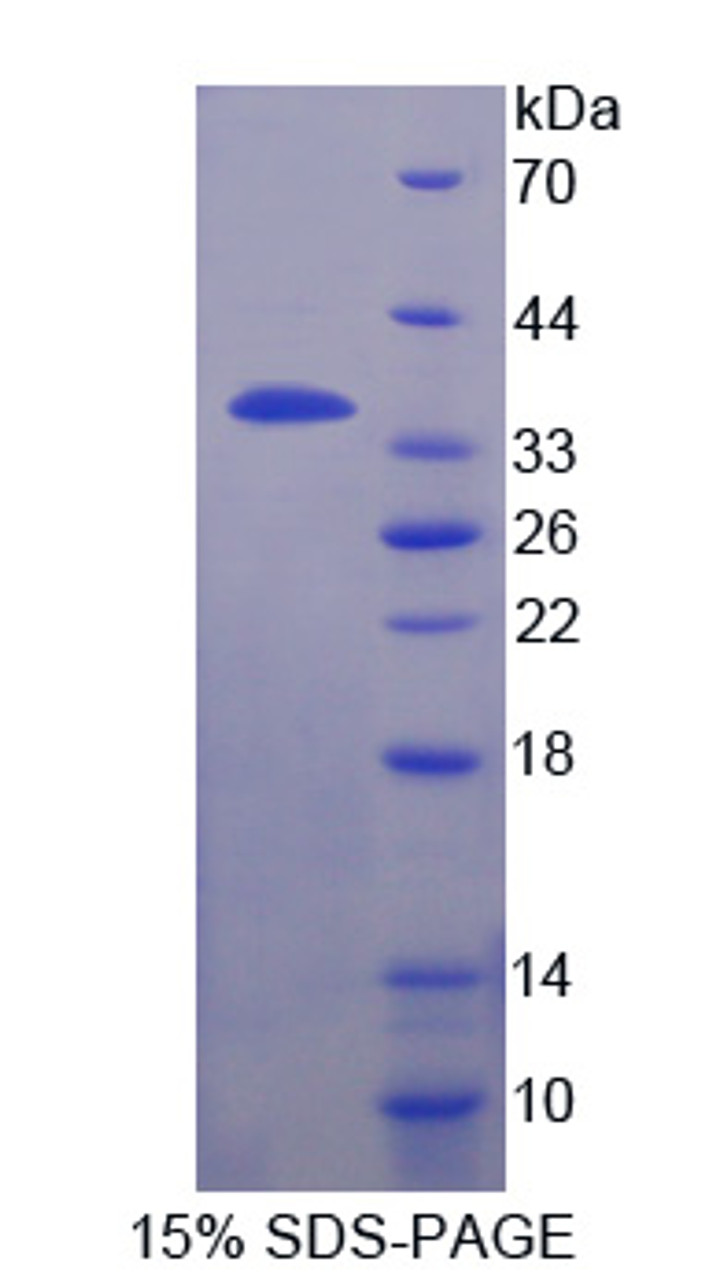 Human Recombinant Fidgetin (FIGN)