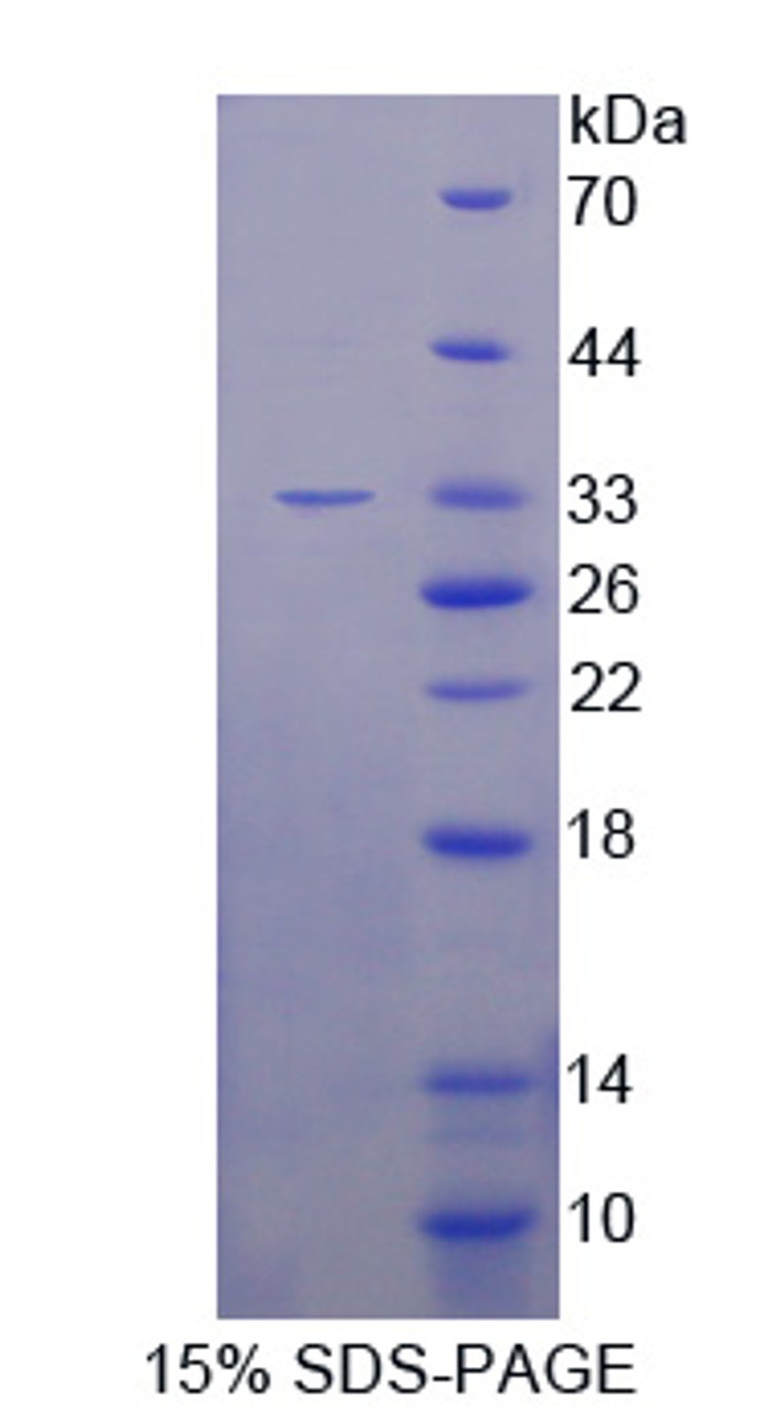 Mouse Recombinant Feline Sarcoma Oncogene (FES)