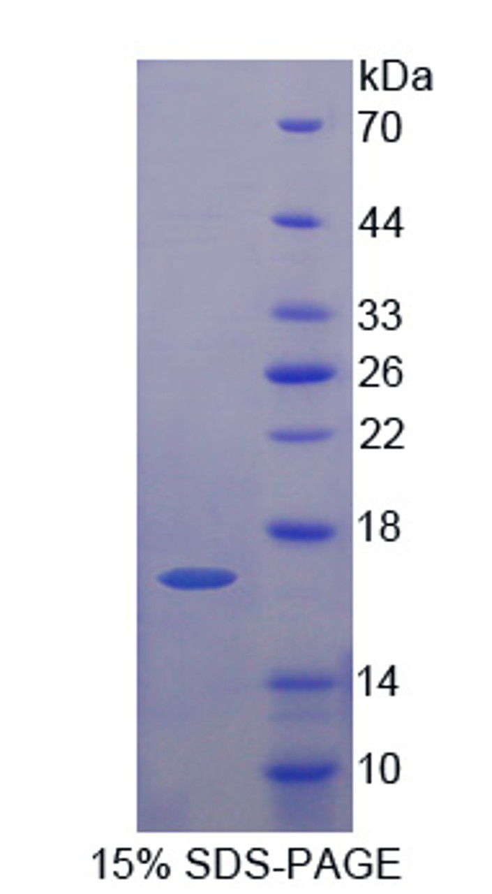 Human Recombinant Early Endosome Antigen 1 (EEA1)