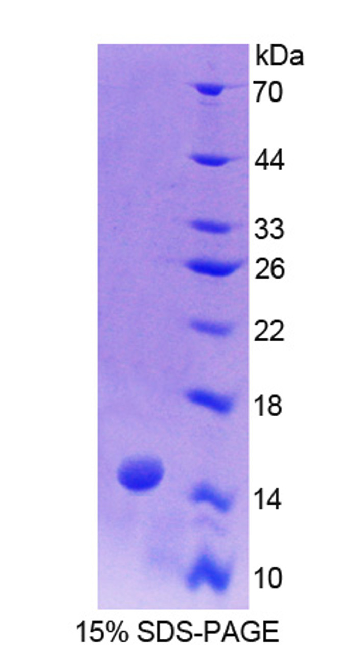 Human Recombinant Biglycan (BGN)