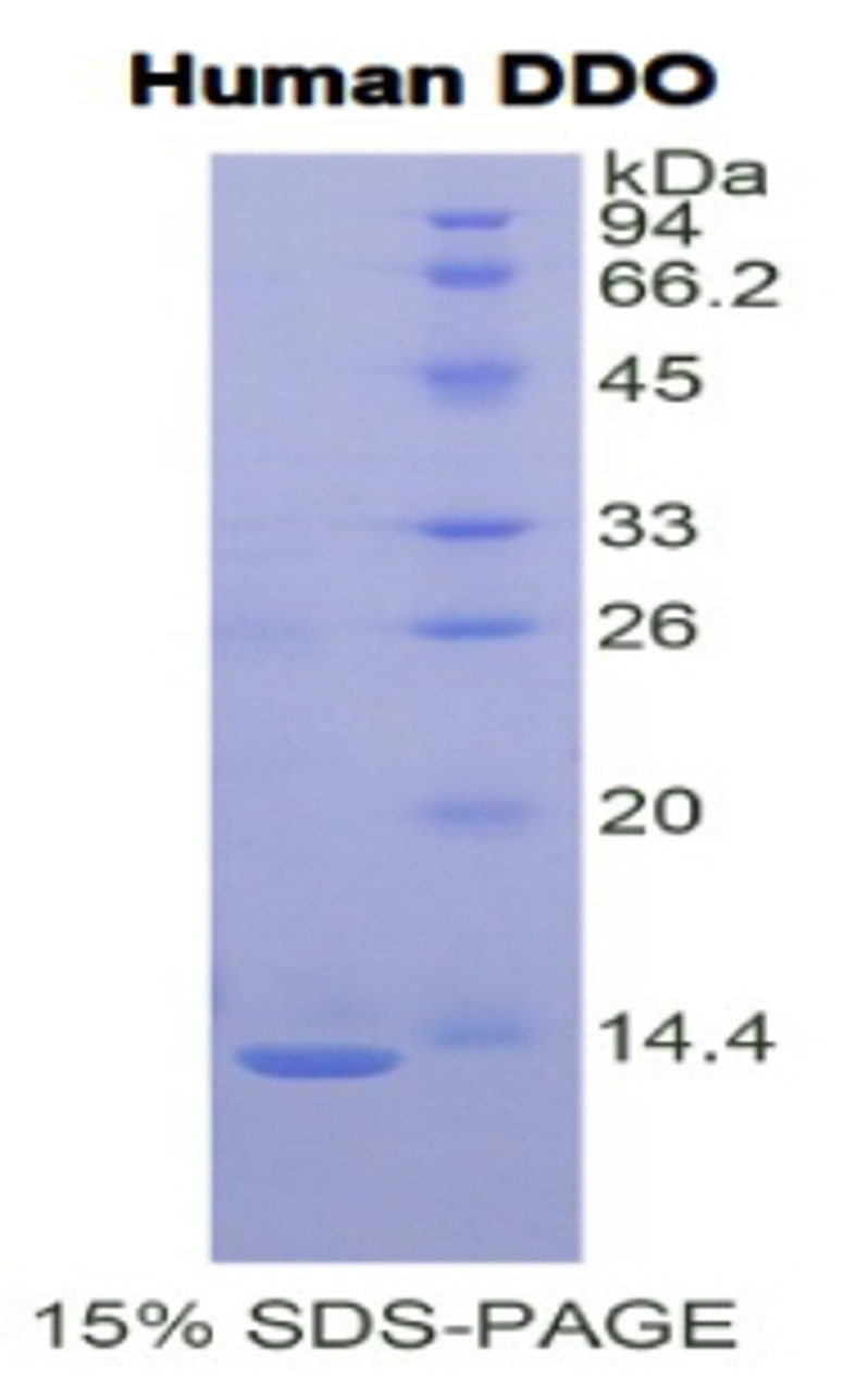 Human Recombinant D-Aspartate Oxidase (DDO)