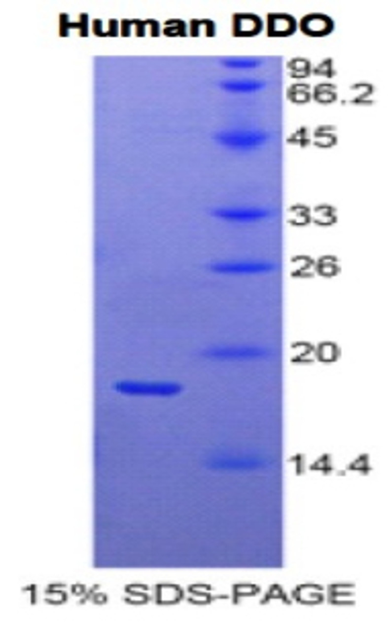 Human Recombinant D-Aspartate Oxidase (DDO)