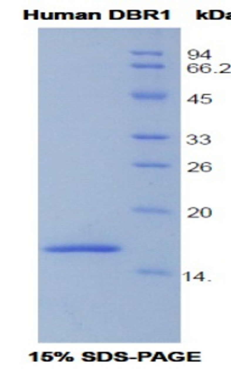 Human Recombinant Debranching Enzyme Homolog 1 (DBR1)