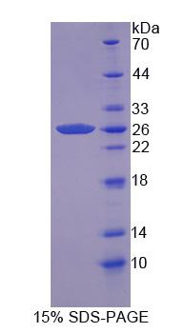 Human Recombinant Casein Kappa (CSN3)